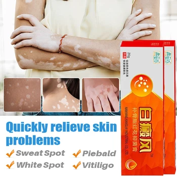 Vitiligo Tedavisi Merhem 20 g/adet Verimli Kaldırmak Cilt Vitiligo Mikoz Bitkisel Çin Tıbbı Cilt Merhem